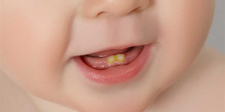 اصفرار أسنان الطفل