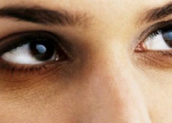 "نصائح جمالية" هكذا ستتخلصين من مشكلة الهالات السوداء