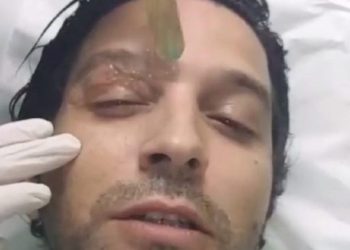 تعاطف كبير للمغاربة مع انس الباز في سلمات ابو البنات بسبب عينه