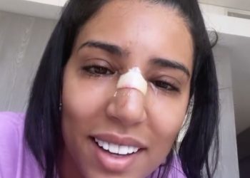 بالصورة٠٠رجاء بلمير تجري عملية جراحية مستعجلة وخطأ طبي يبعثر مسار علاجها