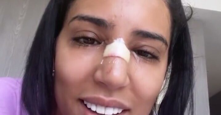 بالصورة٠٠رجاء بلمير تجري عملية جراحية مستعجلة وخطأ طبي يبعثر مسار علاجها