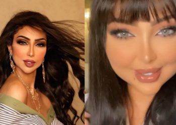 بعد صمت طويل٠٠دنيا بطمة تكشف الحقيقة: “مدرتش عملية تجميل نهائيا”٠٠ فها هو سبب تغير شكلها ؟ (صور)