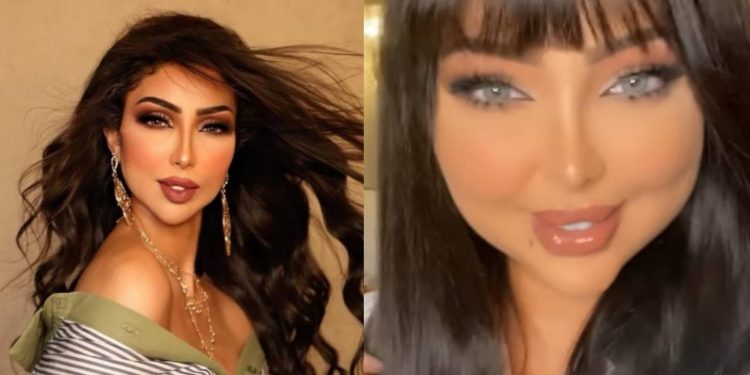 بعد صمت طويل٠٠دنيا بطمة تكشف الحقيقة: “مدرتش عملية تجميل نهائيا”٠٠ فها هو سبب تغير شكلها ؟ (صور)