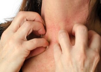 أخطار بعض العطور على جلدك٠٠احذري منها