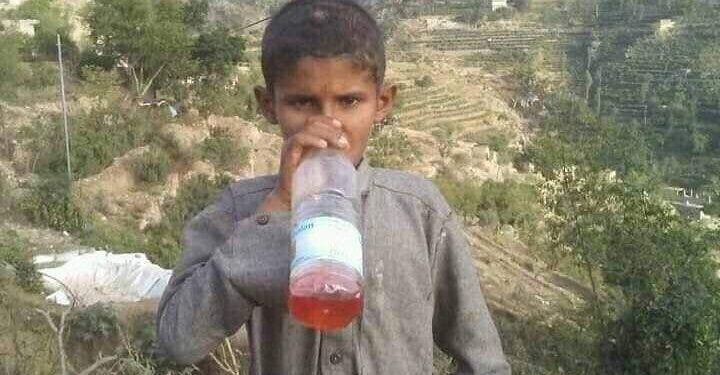 الطفل الاعجوبة..يعيش باستنشاق البنزين ويغمى عليه فور توقفه