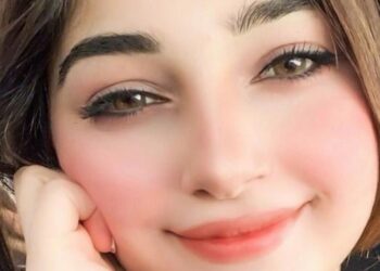 احمرار الخدود٠٠بدون مستحضرات تجميل
