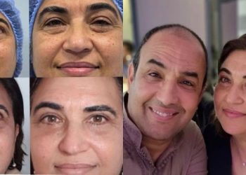 زوجة الفنان رشيد الوالي تصدم متابعيها و تخضع لعملية التجميل “قص الجفون”
