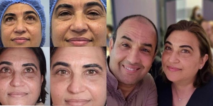 زوجة الفنان رشيد الوالي تصدم متابعيها و تخضع لعملية التجميل “قص الجفون”