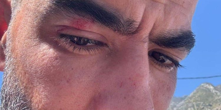 اعتداء على الفنان حميد الحضري