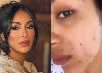 بعد معاناتها مع “بوشويكة”..ماريا نديم تكشف عن جديد حالتها الصحية