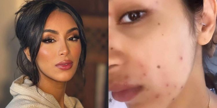 بعد معاناتها مع “بوشويكة”..ماريا نديم تكشف عن جديد حالتها الصحية