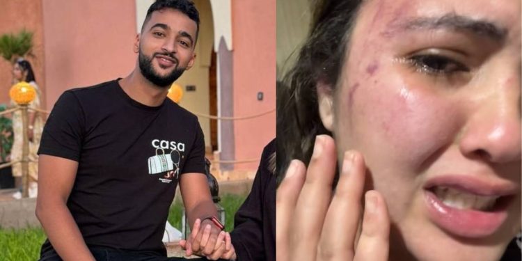 مريم أفلاطونة تتهم زوجها بتعنيفها..تفاصيل