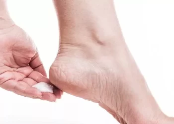 كيف تعالج وتتخلص من مشكل تشقق القدمين بطرق سهلة وفعالة