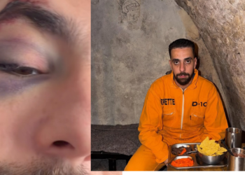 بعد انتشار صور حادثته.. أحمد الصبيري يطمئن متابعيه