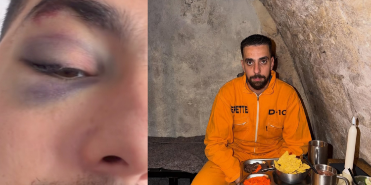 بعد انتشار صور حادثته.. أحمد الصبيري يطمئن متابعيه