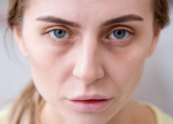 كيف تعيدين الحيوية لبشرتك الشاحبة..خطوات عملية ووصفات طبيعية للجمال الصحي