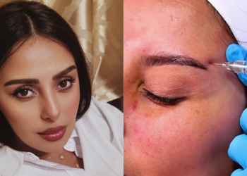 الكوميدية فدوى طالب تكشف عن تعديلات تجميلية وتشارك التفاصيل مع جمهورها