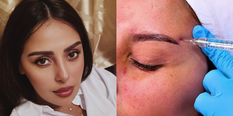 الكوميدية فدوى طالب تكشف عن تعديلات تجميلية وتشارك التفاصيل مع جمهورها