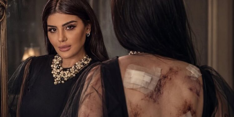 مريم باكوش برسالة مؤثرة: “وراء كل ابتسامة حكاية ألم وصمود”