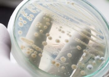 فطريات المهبل.. كيف تعالجين المشكلة وتحافظين على استقرار علاقتك الزوجية؟